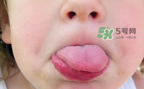 三伏天為什么濕氣重？三伏天為什么要注意祛濕？