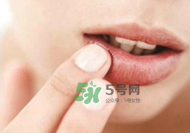 你的嘴唇為什么起泡 嘴唇上的水泡治不好嗎？