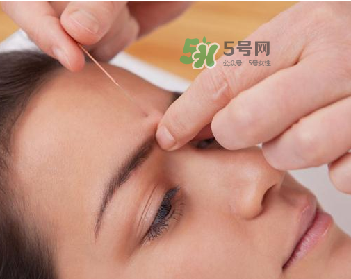 三伏天針灸有什么好處？三伏天針灸注意什么？