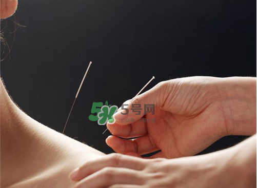 三伏天針灸有什么好處？三伏天針灸注意什么？