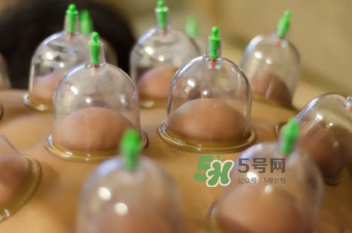 拔火罐是夏天好還是冬天好？什么時(shí)候拔火罐最合適？