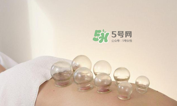 拔火罐是夏天好還是冬天好？什么時(shí)候拔火罐最合適？