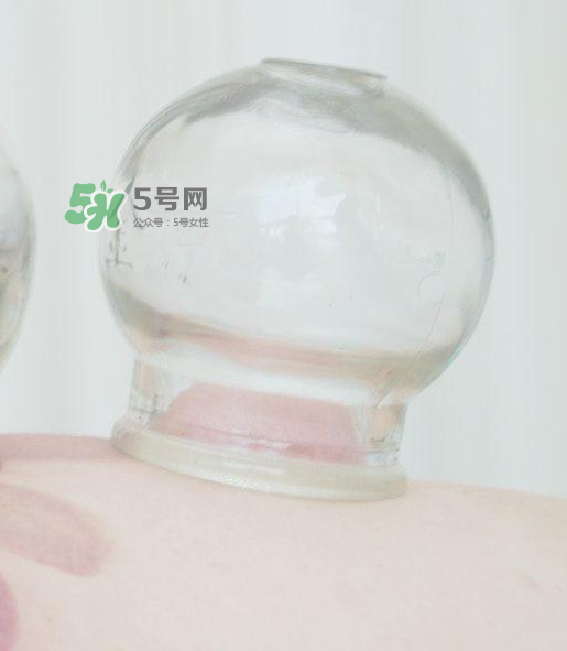 拔火罐一次多長(zhǎng)時(shí)間？拔火罐一般多長(zhǎng)時(shí)間？