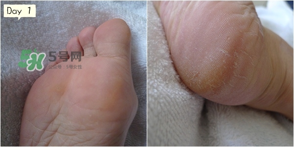 baby foot足膜怎么用？baby foot足膜使用方法