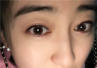做美瞳線會(huì)不會(huì)掉睫毛？做美瞳線掉睫毛怎么辦？