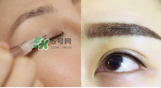 美瞳線有必要做嗎？做美瞳線多少錢(qián)？