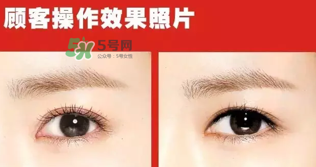美瞳線有必要做嗎？做美瞳線多少錢(qián)？