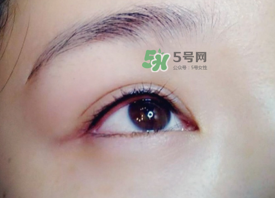 做美瞳線(xiàn)疼嗎？做美瞳線(xiàn)后要注意什么？