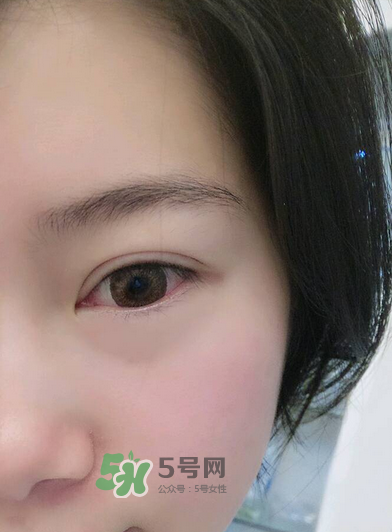做美瞳線(xiàn)疼嗎？做美瞳線(xiàn)后要注意什么？