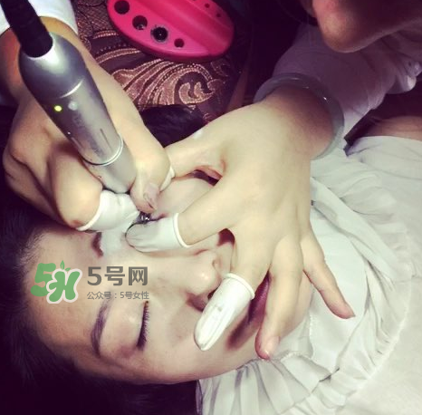 做美瞳線要打麻藥嗎？做美瞳線麻藥怎么敷？