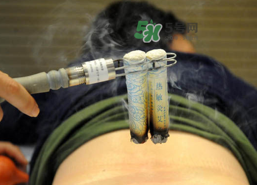 三伏天艾灸后能吹空調(diào)嗎？三伏天艾灸后能吹電扇嗎？