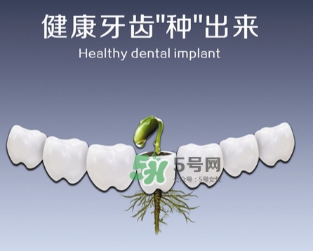 種植牙費用多少錢？國產(chǎn)種植牙價格