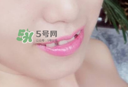 牙齒縫隙大怎么辦？牙縫大帶牙套有用嗎