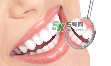 牙齒縫隙大怎么辦？牙縫大帶牙套有用嗎