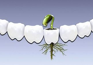 種植牙多少錢一顆？為什么種植牙很貴