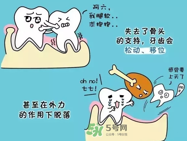 牙齒松動(dòng)會(huì)自己好嗎？牙齒松動(dòng)會(huì)自己掉嗎
