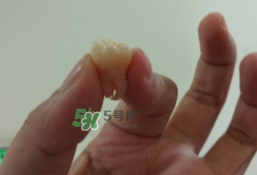 拔智齒痛嗎？智齒拔了多久洞會(huì)好？