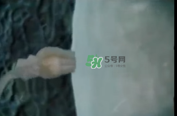 懷孕初期怎么保胎？陰道出血是流產(chǎn)征兆嗎？