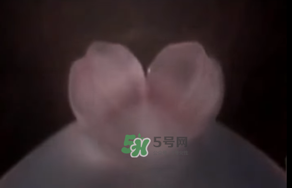懷孕初期怎么保胎？陰道出血是流產(chǎn)征兆嗎？