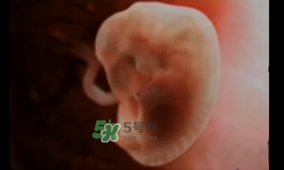懷孕初期怎么保胎？陰道出血是流產(chǎn)征兆嗎？