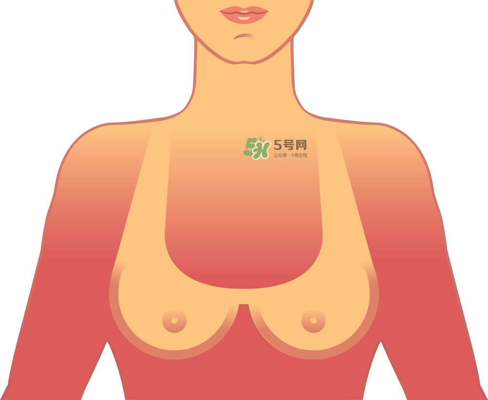 女性乳頭癢是怎么回事？女性乳頭癢要怎么治療？