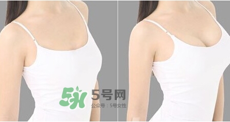 女性乳頭癢是怎么回事？女性乳頭癢要怎么治療？