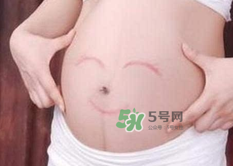 產(chǎn)婦胃脹氣怎么緩解？產(chǎn)婦胃脹氣怎么辦？
