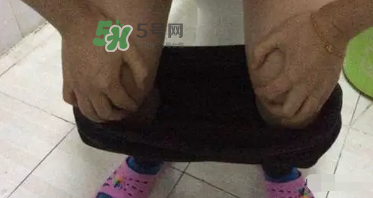 孕期可以蹲著上廁所嗎？孕期上廁所會(huì)壓到寶寶嗎？