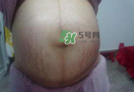 懷女孩肚子上會(huì)長毛嗎？懷女孩肚子特征圖片