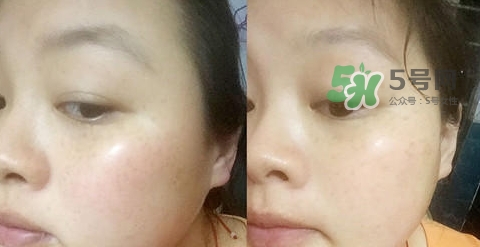 可思美潔面儀好不好用？可思美凈致潔顏聲波潔面儀怎么樣？
