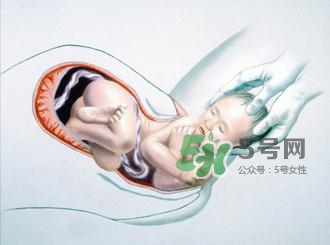 順產和剖腹產哪個好？順產和剖腹產哪個痛？