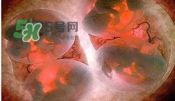 多胞胎是怎么生產(chǎn)的？多胞胎應(yīng)選擇什么分娩方式