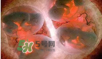 多胞胎順產(chǎn)怎么生？多胞胎剖腹產(chǎn)和單胎剖腹產(chǎn)的區(qū)別