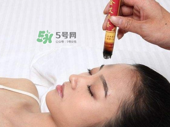 艾灸會(huì)不會(huì)過(guò)敏？艾灸過(guò)敏怎么辦