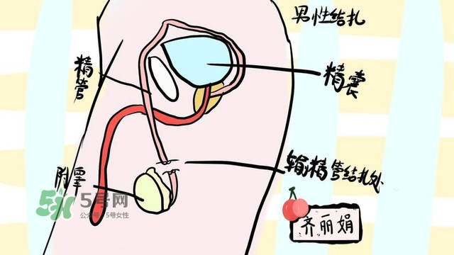 生完二胎一定要結(jié)扎嗎？生完二胎結(jié)扎好不好？