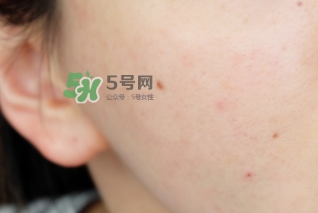 臘梅是什么牌子？臘梅是什么護膚品