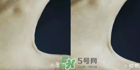 小黑瓶和小棕瓶可以一起用嗎？小棕瓶和小黑瓶哪個先用