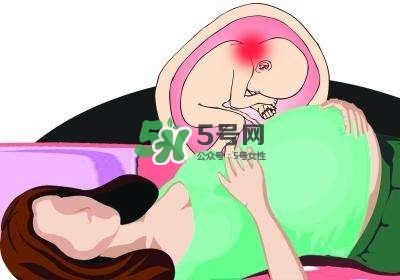 孕婦左側臥睡不著怎么辦？孕期左側睡不舒服怎么辦？