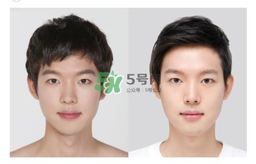 美白針有副作用嗎？美白針有什么副作用？