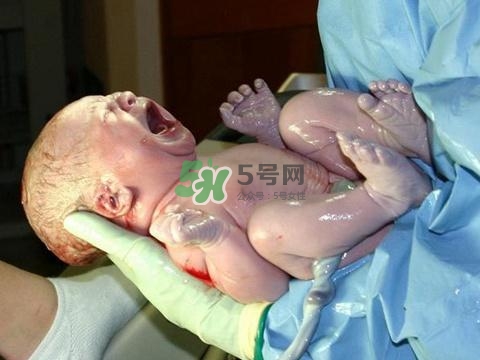 順產(chǎn)有多疼？順產(chǎn)的疼痛可以忍受嗎？