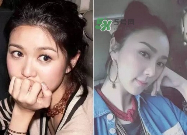 發(fā)際線低怎么調(diào)整？標(biāo)準(zhǔn)的發(fā)際線圖片