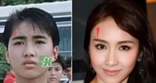 發(fā)際線低怎么調(diào)整？標(biāo)準(zhǔn)的發(fā)際線圖片