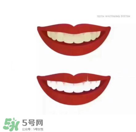 美牙儀能帶上飛機嗎？美牙儀可以過安檢嗎？