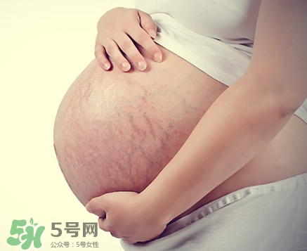 孕婦胸部長妊娠紋嗎？胸部長妊娠紋了怎么辦？