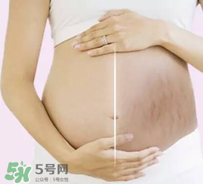 長(zhǎng)妊娠紋的前兆 長(zhǎng)妊娠紋很癢怎么辦？