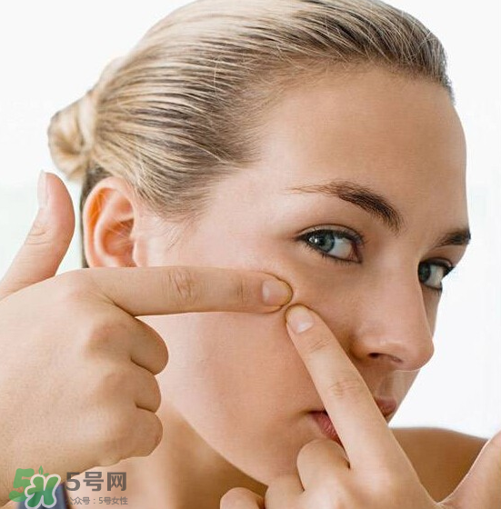 長痘長閉口怎么辦？長痘長閉口是什么原因？