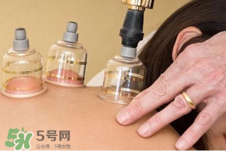 真空拔罐有用嗎？真空拔罐多長時間合適