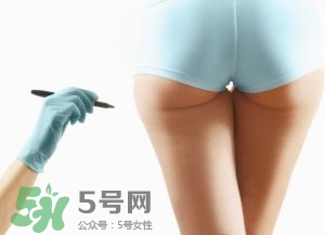 吸脂減肥副作用有哪些？吸脂減肥可靠嗎？