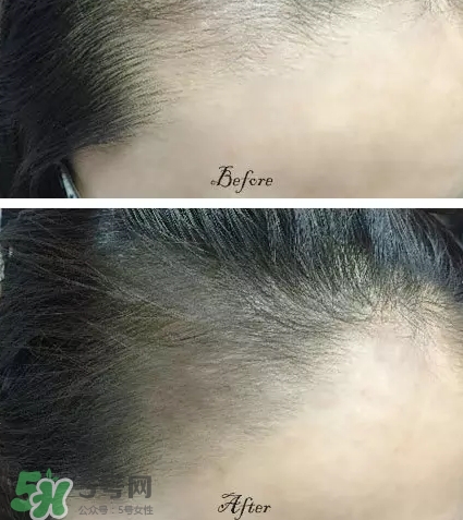 發(fā)際線粉要卸妝嗎_怎么卸？
