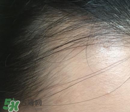 發(fā)際線粉要卸妝嗎_怎么卸？